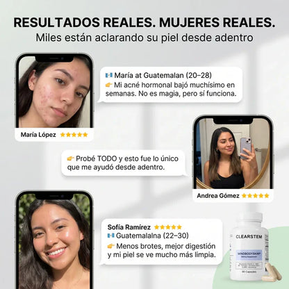 CLEARSTEM: El "Detox" interno que frena el acné hormonal de raíz.